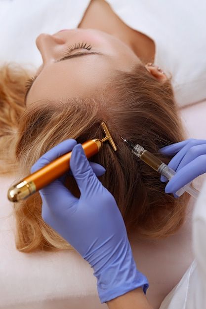 PRP for Hair Loss Treatment Toronto