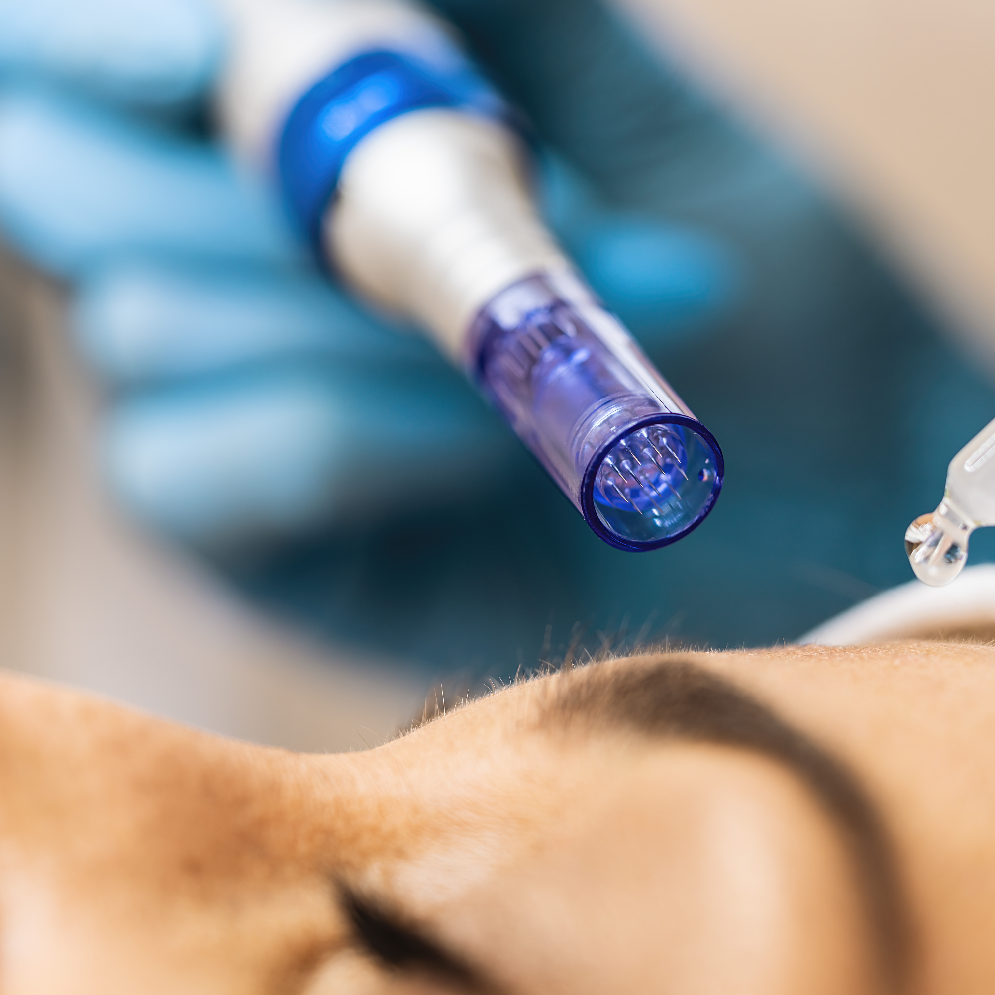 Microneedling treatment Toronto