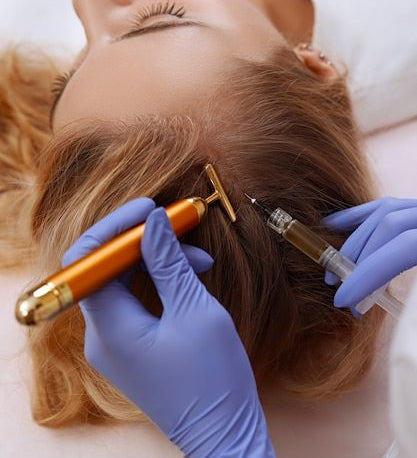 PRP for Hair Loss Treatment Toronto